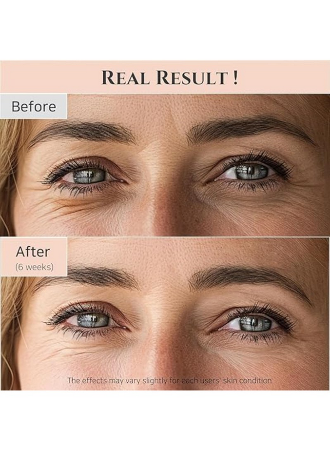 Revive Eye Serum with Retinal, Niacinamide & Peptides – 30ml